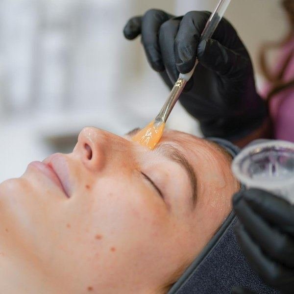 Oxfoliation step of Glo2Facial