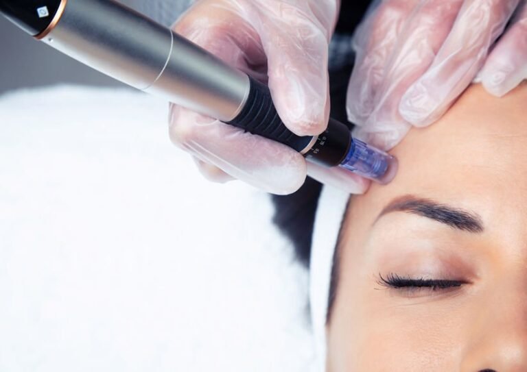 Microneedling results day by day during the skin recovery process