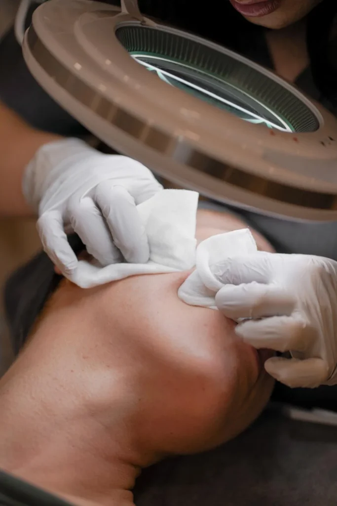 How to Treat Clogged Pores on Staten Island